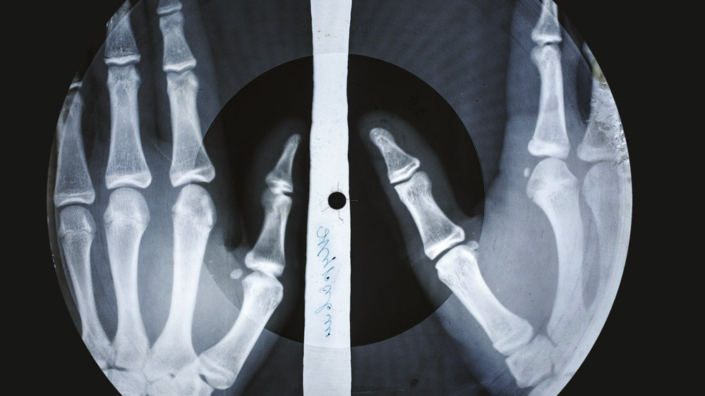 bonemusic