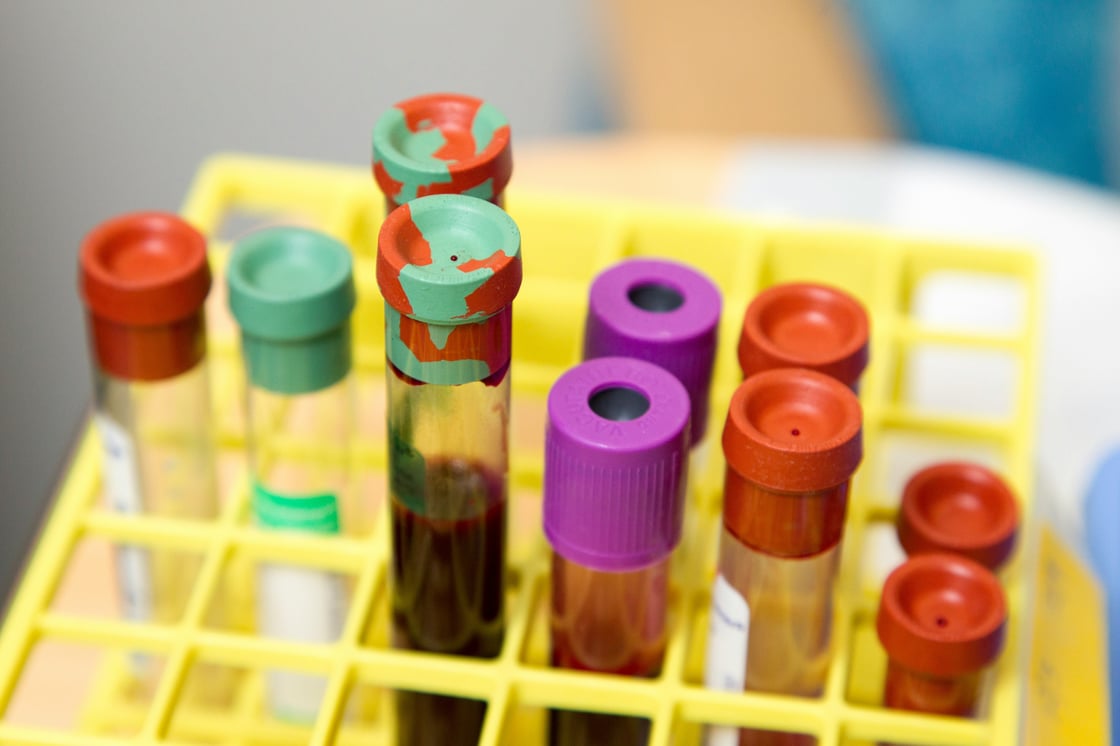 national-cancer-institute-egT3xtDu9DQ-unsplash